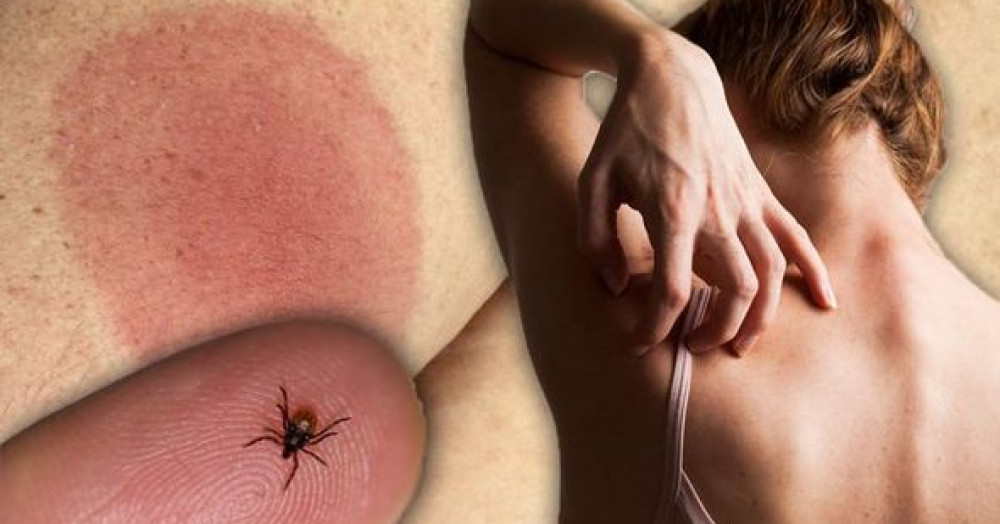 The danger of Lyme disease